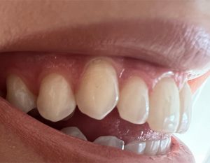 Dental Smile
